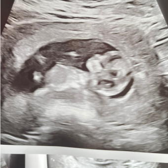 Babylist Registry Photo.