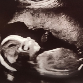 Babylist Registry Photo.