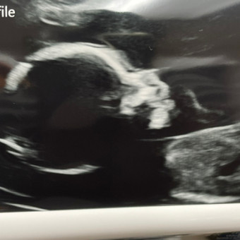 Babylist Registry Photo.