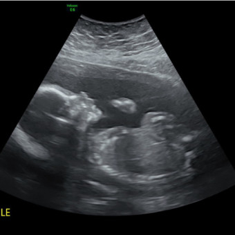 Babylist Registry Photo.