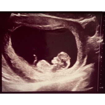 Babylist Registry Photo.