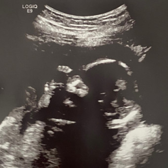 Babylist Registry Photo.