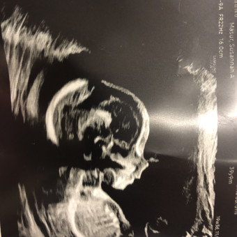 Babylist Registry Photo.