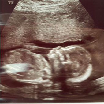 Babylist Registry Photo.