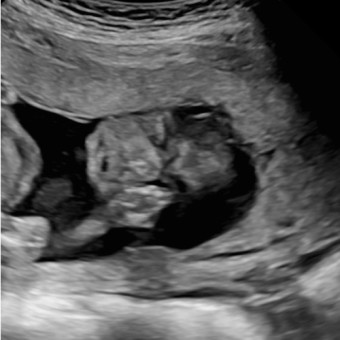 Babylist Registry Photo.
