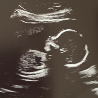 Babylist Registry Photo.
