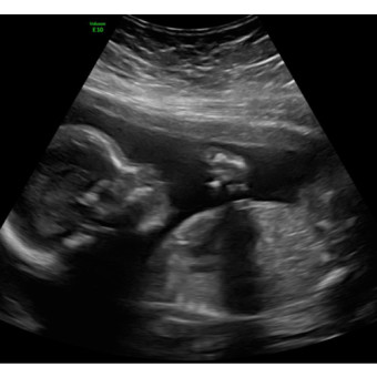 Babylist Registry Photo.