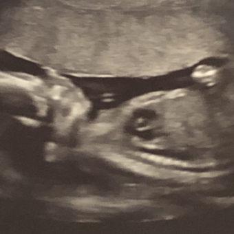 Babylist Registry Photo.