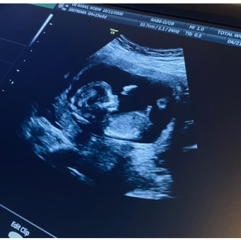 Babylist Registry Photo.