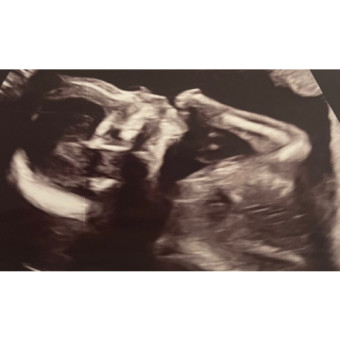 Babylist Registry Photo.
