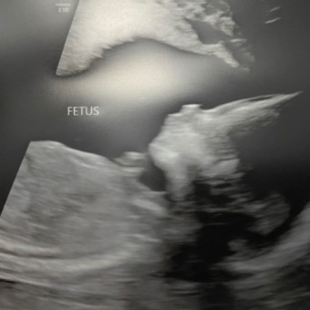Babylist Registry Photo.