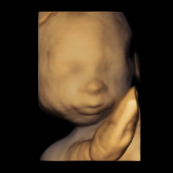 Babylist Registry Photo.