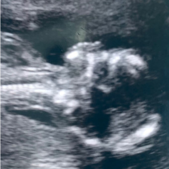 Babylist Registry Photo.