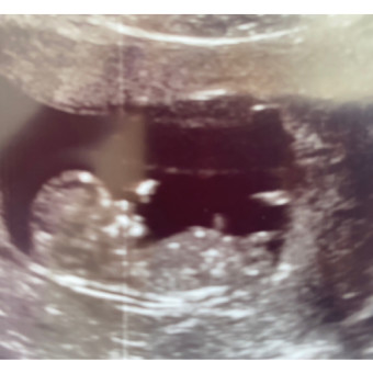 Babylist Registry Photo.