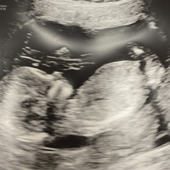 Babylist Registry Photo.