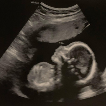 Babylist Registry Photo.