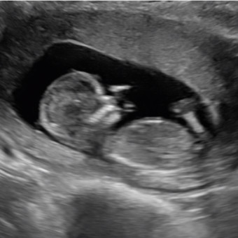 Babylist Registry Photo.
