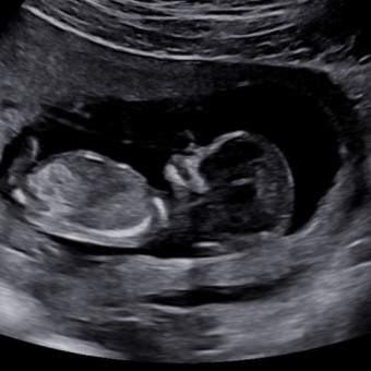 Babylist Registry Photo.