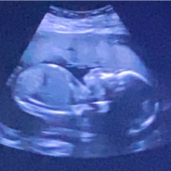 Babylist Registry Photo.