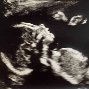 Babylist Registry Photo.