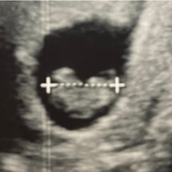 Babylist Registry Photo.