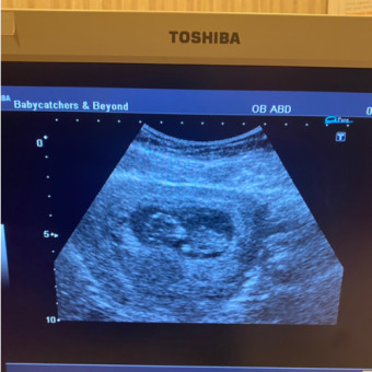 Babylist Registry Photo.