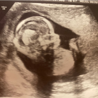 Babylist Registry Photo.