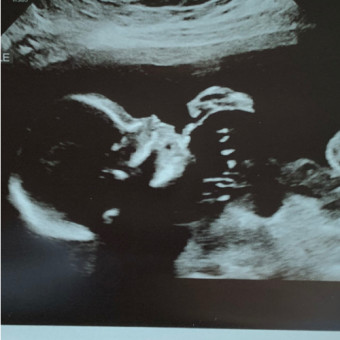 Babylist Registry Photo.