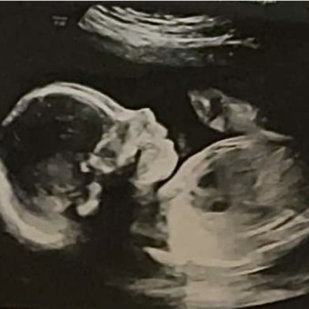 Babylist Registry Photo.