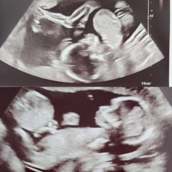 Babylist Registry Photo.