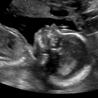Babylist Registry Photo.