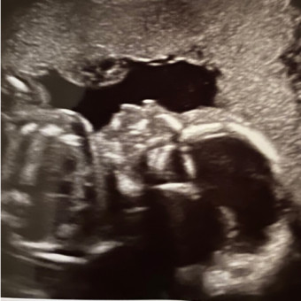 Babylist Registry Photo.