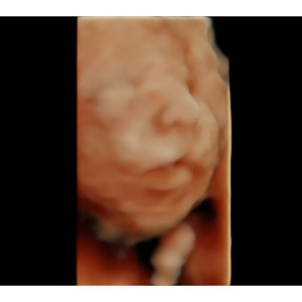 Babylist Registry Photo.
