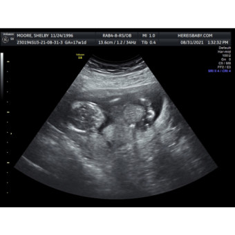 Babylist Registry Photo.