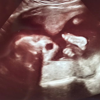Babylist Registry Photo.