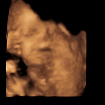 Babylist Registry Photo.
