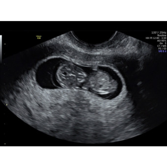 Babylist Registry Photo.