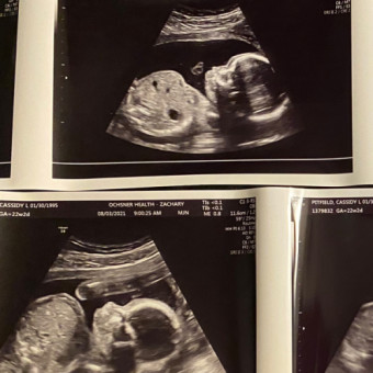 Babylist Registry Photo.