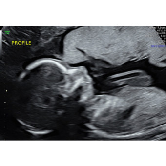 Babylist Registry Photo.