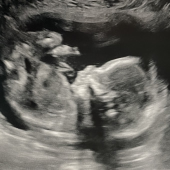 Babylist Registry Photo.