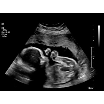 Babylist Registry Photo.