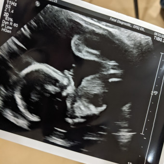 Babylist Registry Photo.
