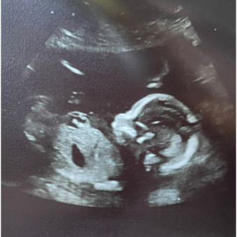 Babylist Registry Photo.