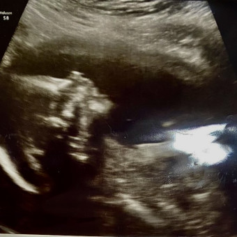 Babylist Registry Photo.
