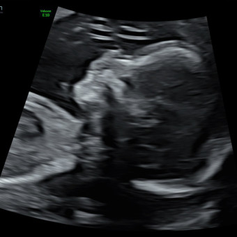 Babylist Registry Photo.