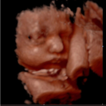 Babylist Registry Photo.