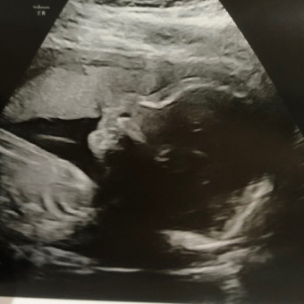 Babylist Registry Photo.