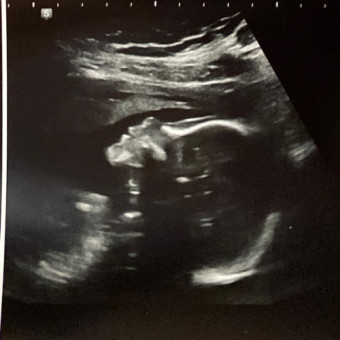 Babylist Registry Photo.