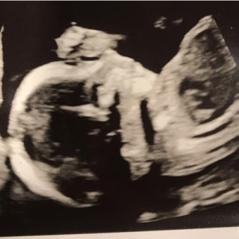 Babylist Registry Photo.
