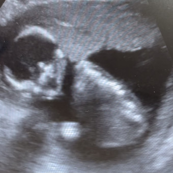 Babylist Registry Photo.